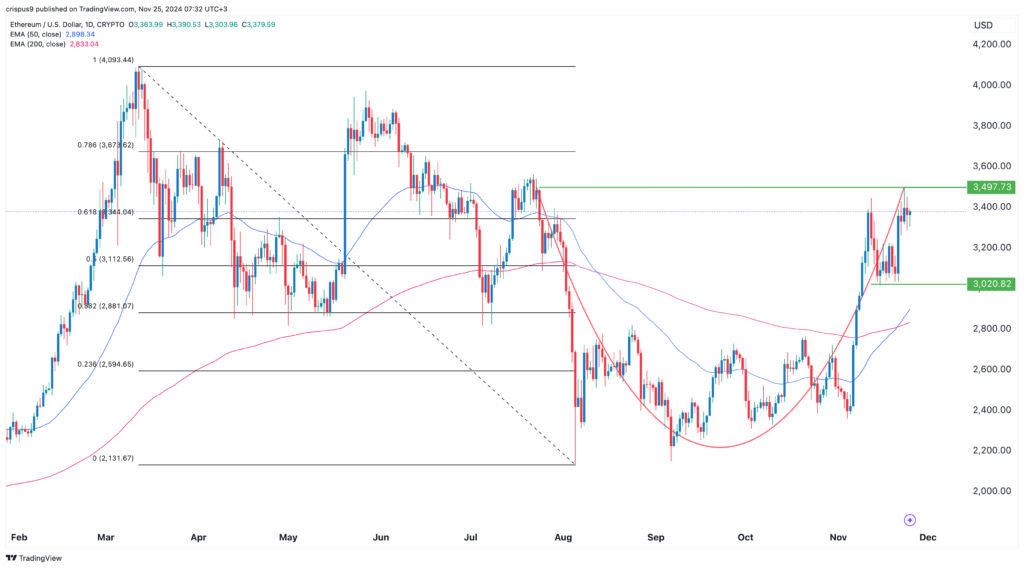 Ethereum price prediction: here’s why ETH could surge soon