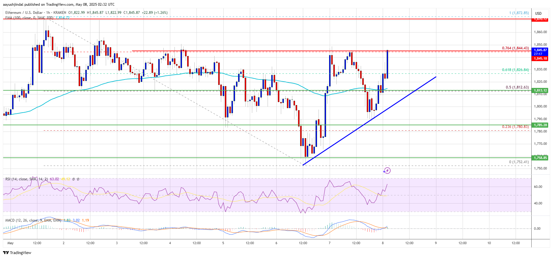 Ethereum Price Ready to Surge—$2,000 Level Could Be Within Reach