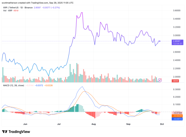 XRP Short Squeeze: Analyst Reveals Available Trading Supply Could Fall To Bitcoin’s 21 Million XRP Short Squeeze: Analyst Reveals Available Trading Supply Could Fall To Bitcoin’s 21 Million